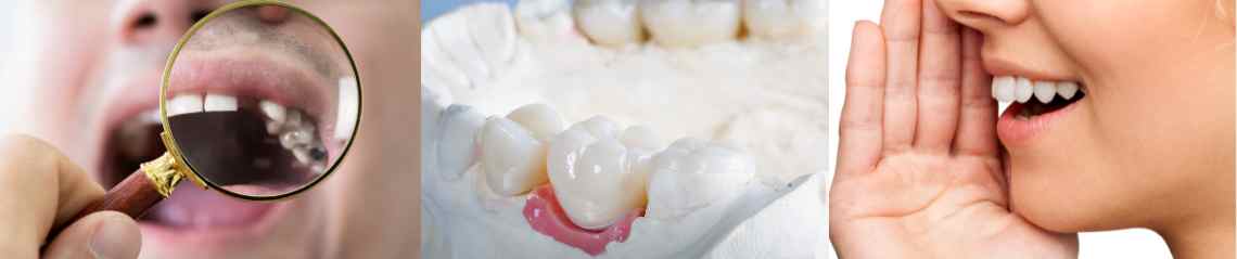 Three different images of Preventing Tooth Shifting, Halting Bone Loss and Restoring Speech