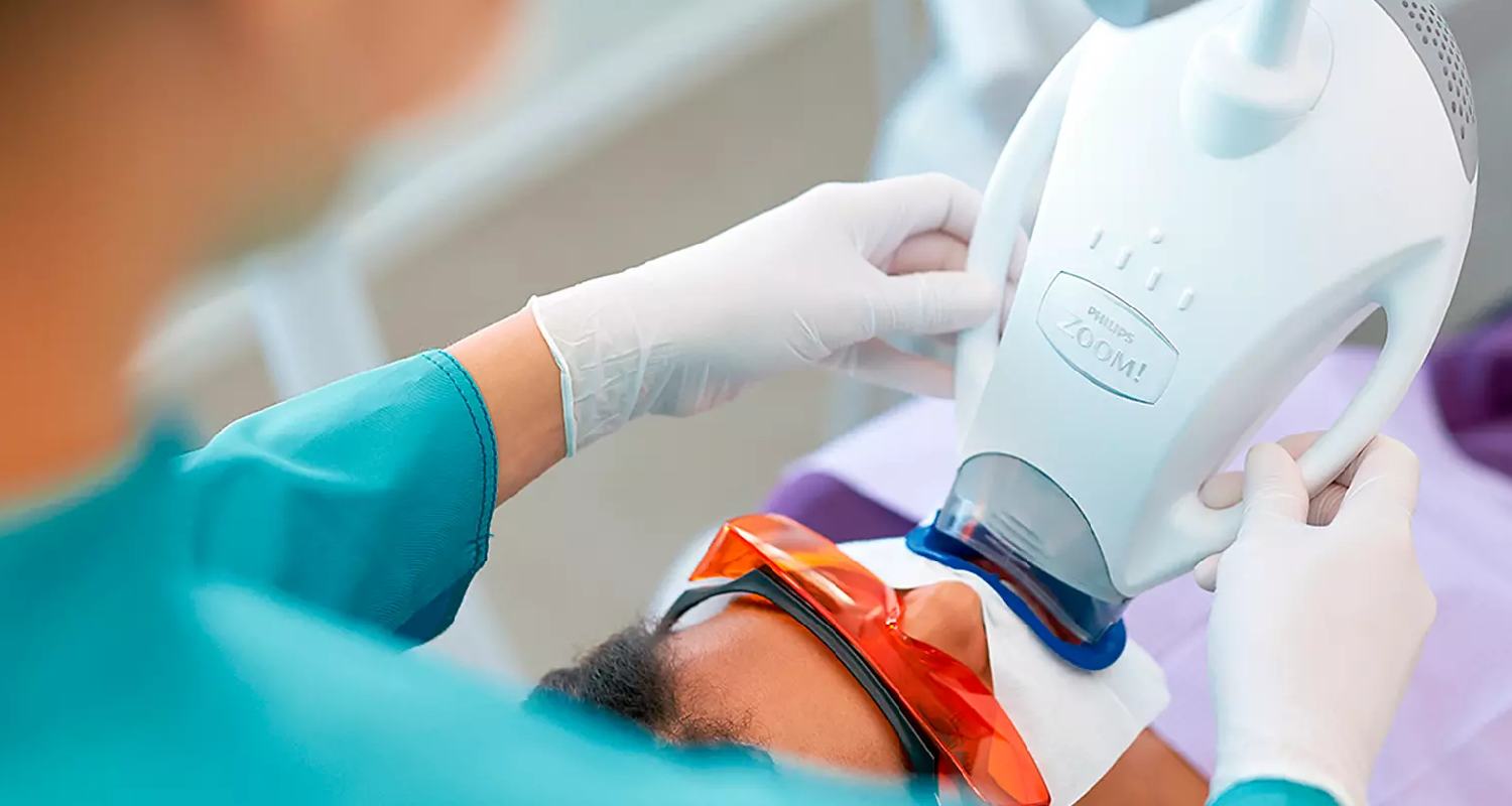 Teeth Whitening