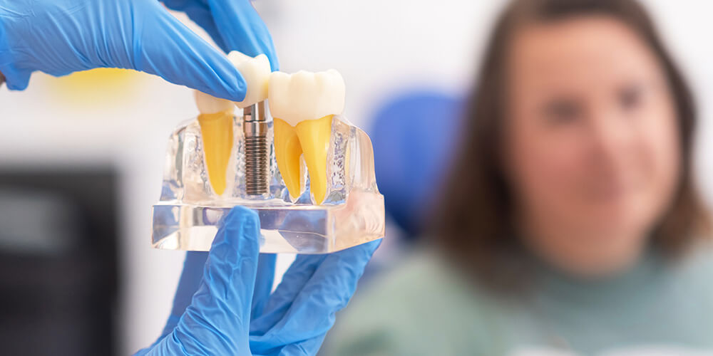 Dental implant care