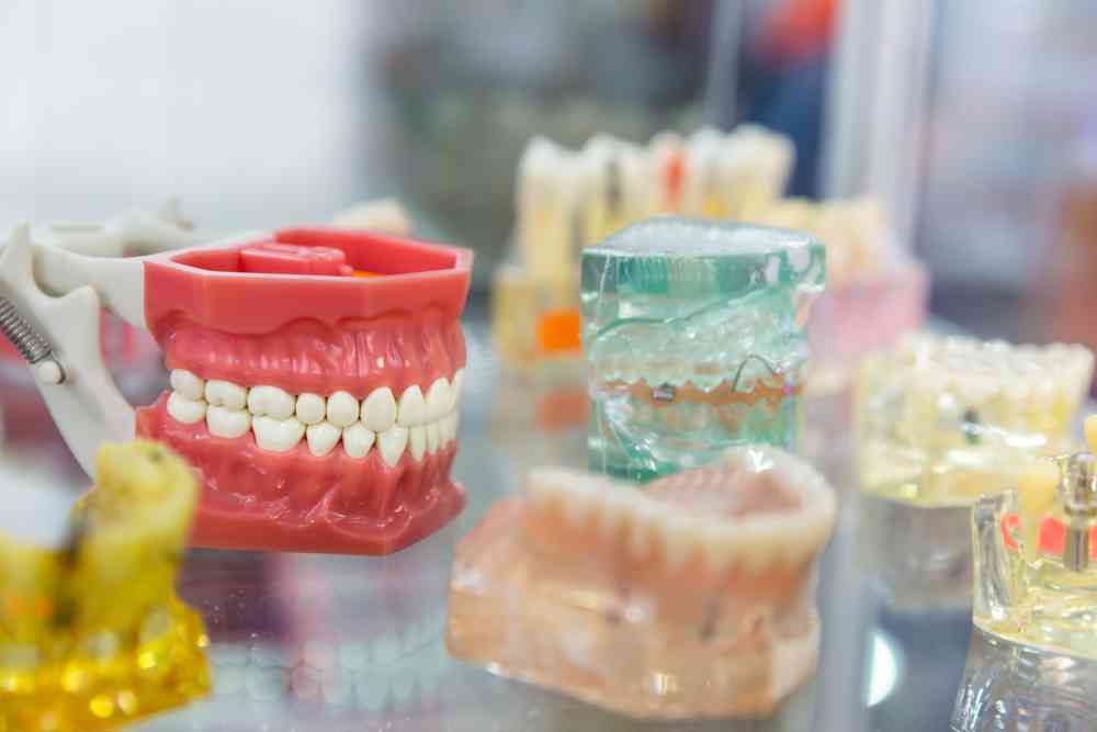 What Should I Choose Implant Or Denture?