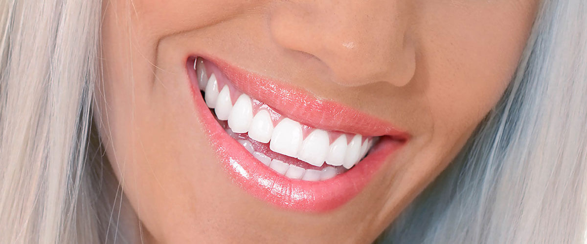 Professional Teeth Whitening vs. Store-Bought Strips: What Actually Works?