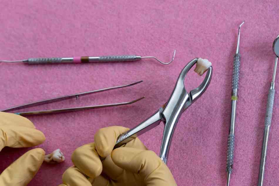 What Will Affect Losing A Tooth?
