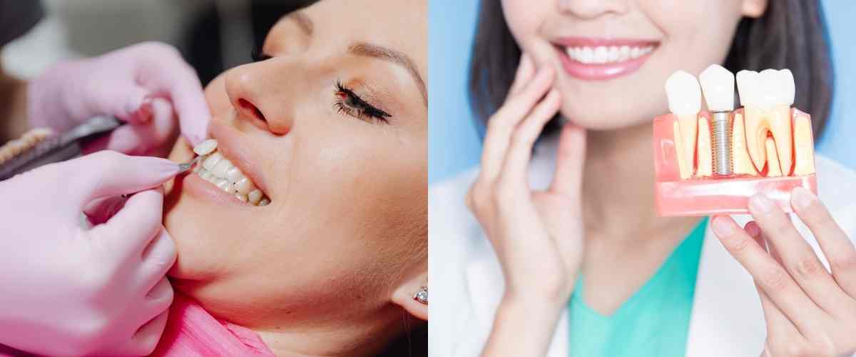Veneers vs. Implants: What's the Difference and Which One is Right for You?