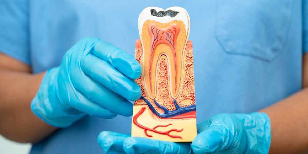 What is a Root Canal Retreatment